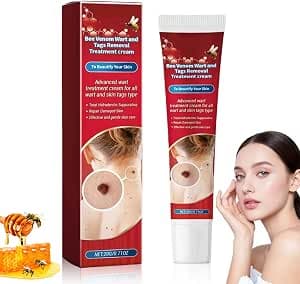 Wart and Tag Remover Cream, Wart Removal&Tag Recede Cream, Skin Tag Removal, Skin Tag Removal Kit for Hands & BodyFor Common Warts Plantar Warts, Corn and Calluse, Suitable for All Skin Types